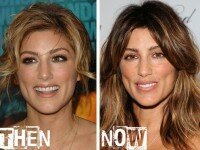 Jennifer Esposito plastic surgery