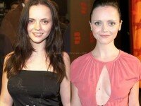 Christina Ricci Breast Reduction